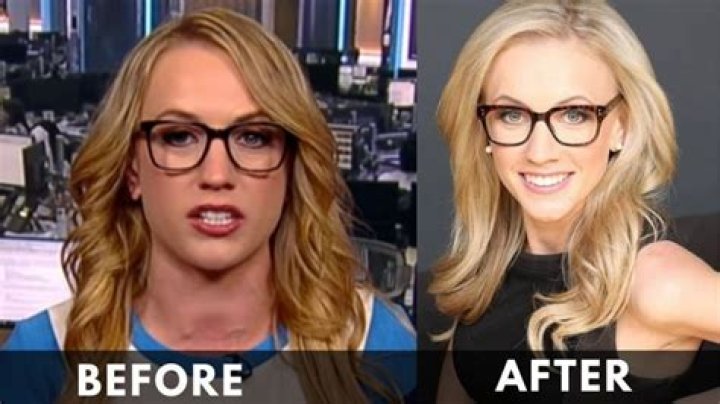Kat Timpf Weight Loss Before & After Journey WorldWire