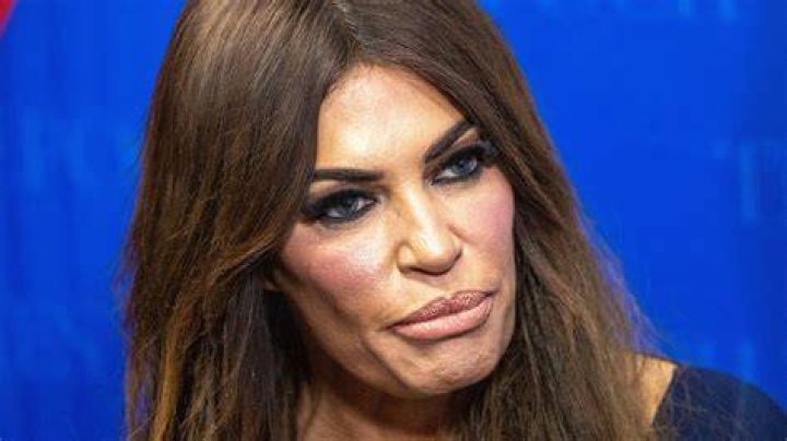 Kimberly Guilfoyle's Plastic Surgery Journey: Unlocking Beauty Secrets